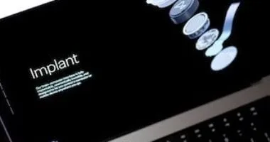 نيورالينك تكشف عن شريحة دماغية متقدمة تمكّن قردًا من إدراك أشياء غير موجودة